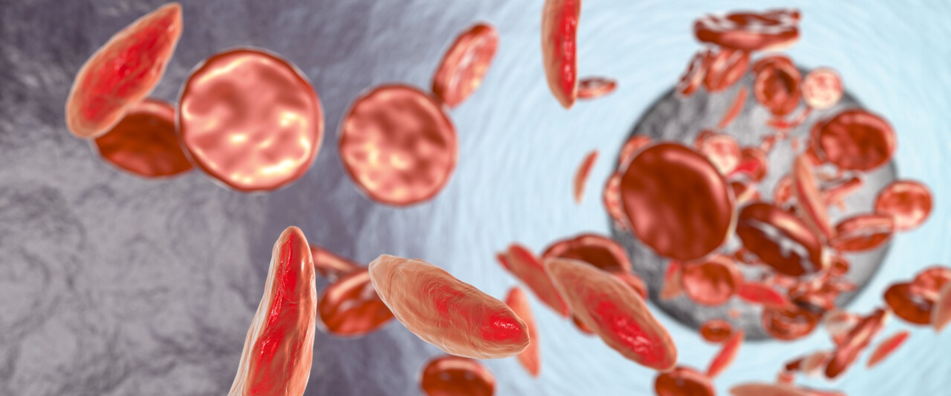 Difference Between Sickle Cell Anemia and Disease: Why the Right Terminology Can Improve Support and Awareness