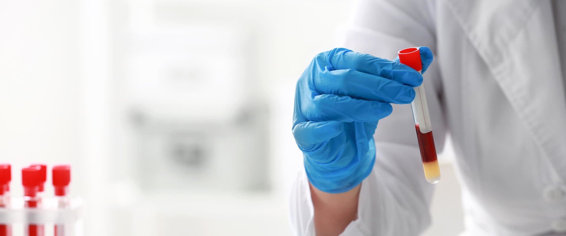 The Importance of Regular Well Person Blood Profiles