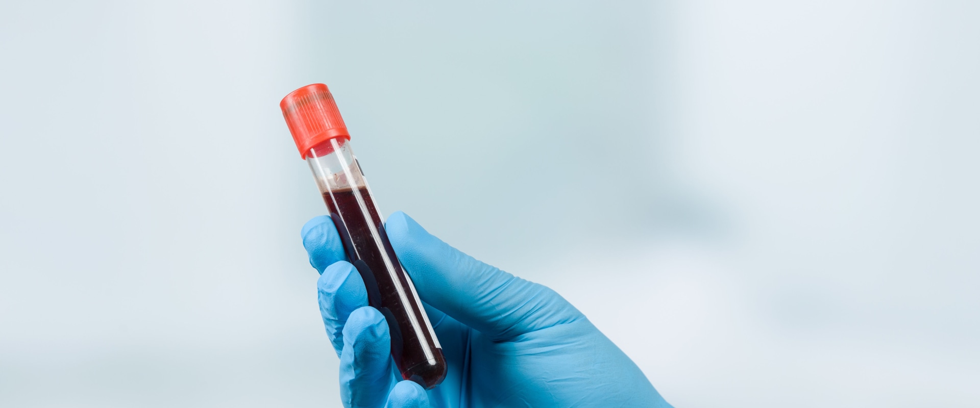 The Importance of Early Detection: Why PSA Testing Should Be Part of Your Annual Wellness Exam