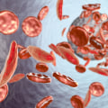 Difference Between Sickle Cell Anemia and Disease: Why the Right Terminology Can Improve Support and Awareness