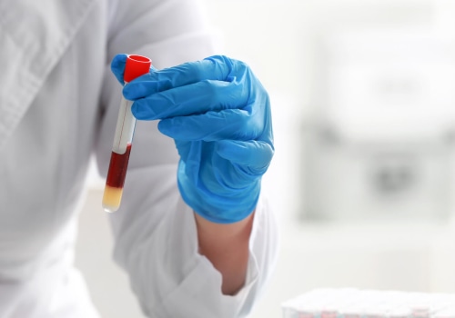 The Importance of Regular Well Person Blood Profiles